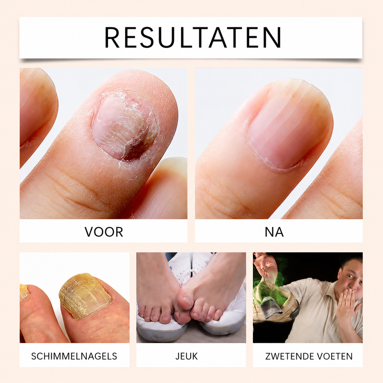 NailCure™ | Voor Gezonde, Schone En Perfect Verzorgde Nagels | 1+1 GRATIS