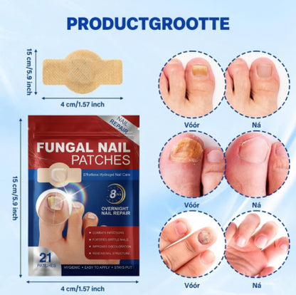 CuraNail™ | Herstelt Uw Nagels Terwijl U Slaapt | 1+1 gratis (42 pleisters)