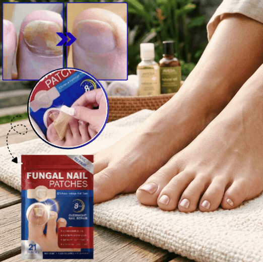 CuraNail™ | Herstelt Uw Nagels Terwijl U Slaapt | 1+1 gratis (42 pleisters)
