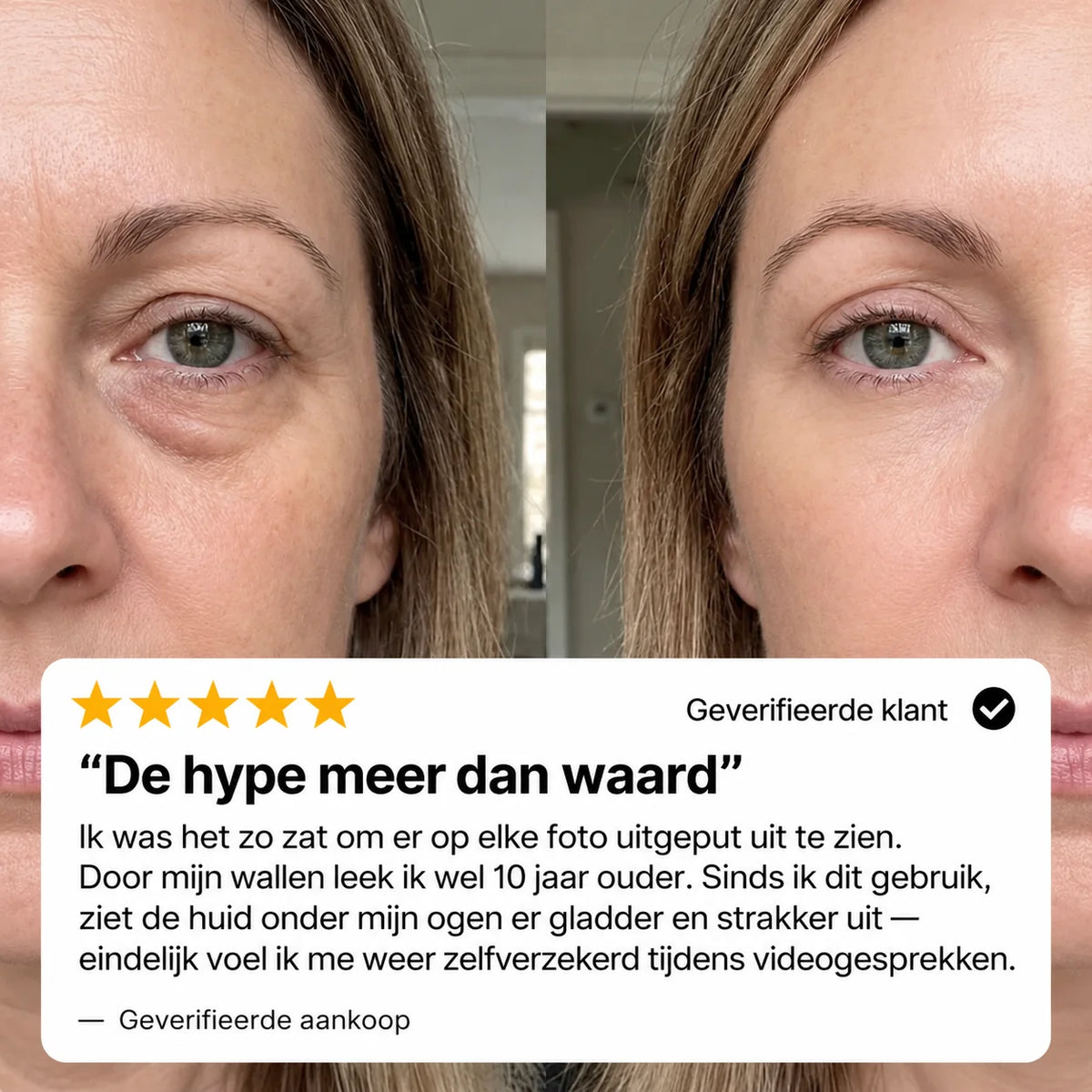 EyeLift™ | Laat wallen verdwijnen & strijk rimpeltjes glad in enkele minuten | 1+1 gratis