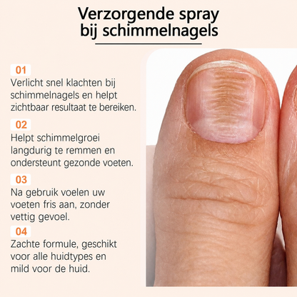 NailCure™ | Voor Gezonde, Schone En Perfect Verzorgde Nagels | 1+1 GRATIS