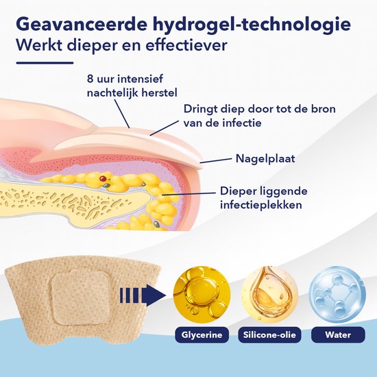 CuraNail™ | Herstelt Uw Nagels Terwijl U Slaapt | 1+1 gratis (42 pleisters)