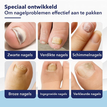 CuraNail™ | Herstelt Uw Nagels Terwijl U Slaapt | 1+1 gratis (42 pleisters)