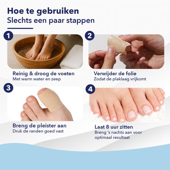 CuraNail™ | Herstelt Uw Nagels Terwijl U Slaapt | 1+1 gratis (42 pleisters)