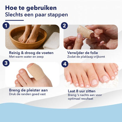 CuraNail™ | Herstelt Uw Nagels Terwijl U Slaapt | 1+1 gratis (42 pleisters)