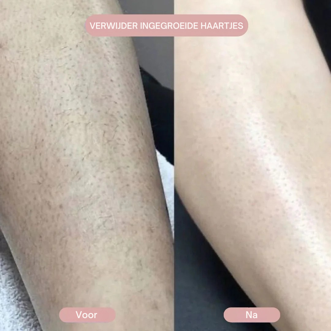 SilkShave™ | Zijde zachte huid, zonder irritatie