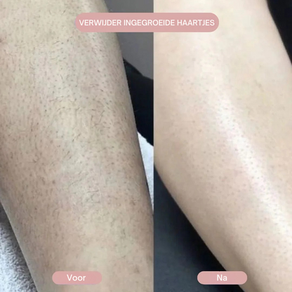SilkShave™ | Zijde zachte huid, zonder irritatie
