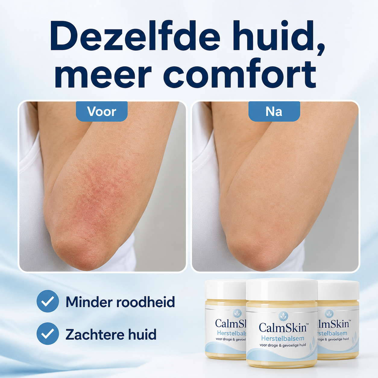 CalmSkin™ | Intensieve herstelbalsem bij droogheid, roodheid en schilfers