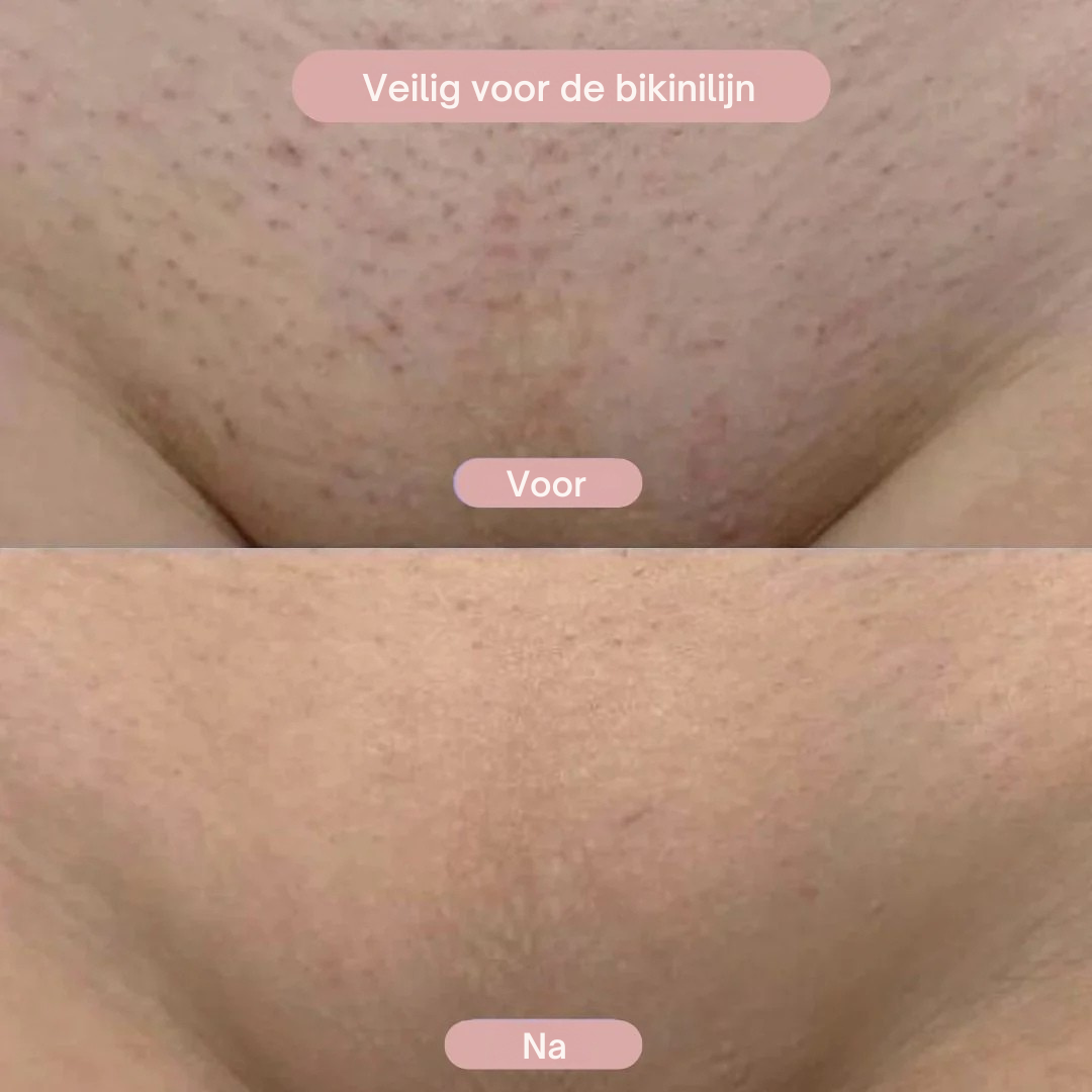 SilkShave™ | Zijde zachte huid, zonder irritatie