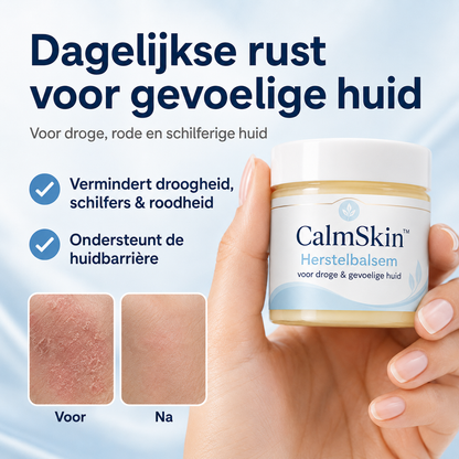 CalmSkin™ | Intensieve herstelbalsem bij droogheid, roodheid en schilfers