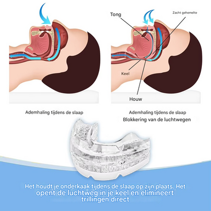 SomnoPro™ | De medische doorbraak die slaapapneu en snurken definitief stopt