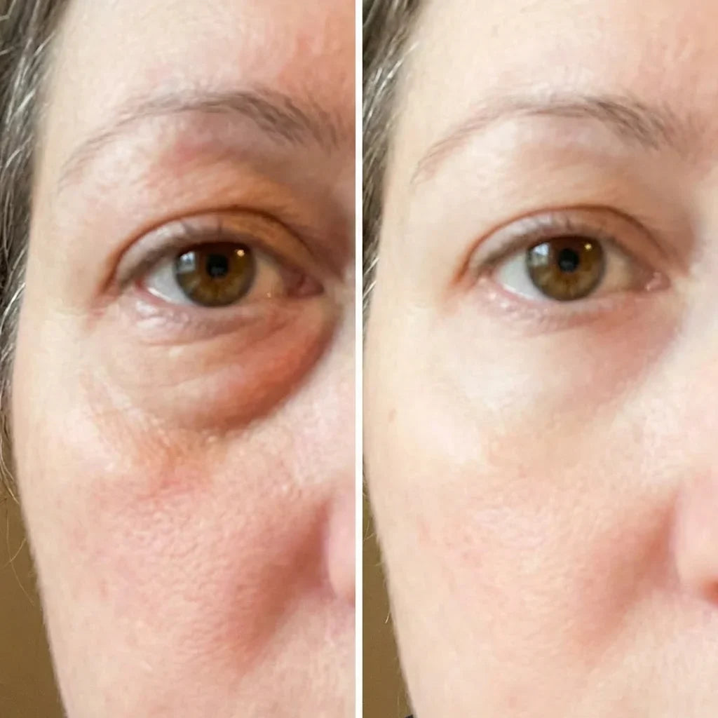 EyeLift™ | Laat wallen verdwijnen & strijk rimpeltjes glad in enkele minuten | 1+1 gratis