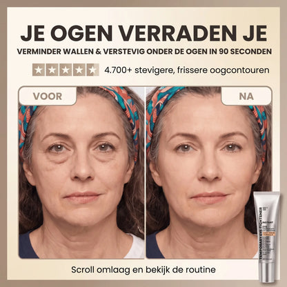 EyeLift™ | Laat wallen verdwijnen & strijk rimpeltjes glad in enkele minuten | 1+1 gratis